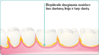 explore-image-oral-care-vap-facts-LT2