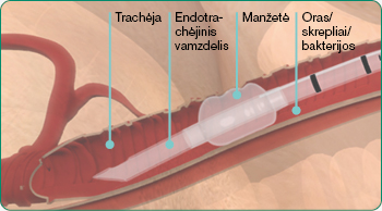explore-image-oral-care-vap-facts-LT3