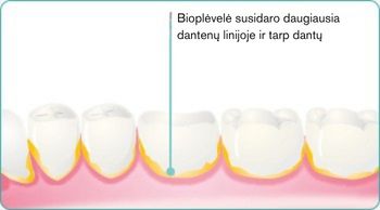LT-explore-image-oral-care-vap-facts-2