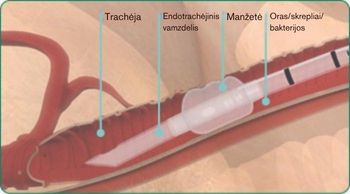 LT-explore-image-oral-care-vap-facts-3